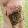 The Goalscoring Knee