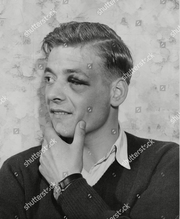 willie-bauld-footballer-with-a-black-eye-box-710-41710168-a-jpg-shutterstock-editorial-9005340a.jpg