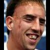 Ribery's Face